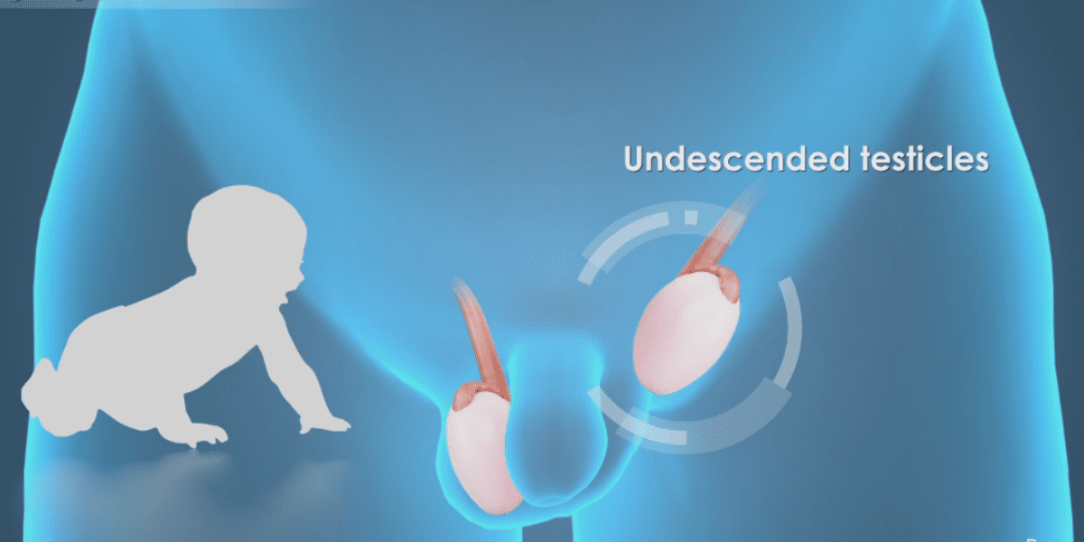 İnmemiş Testis