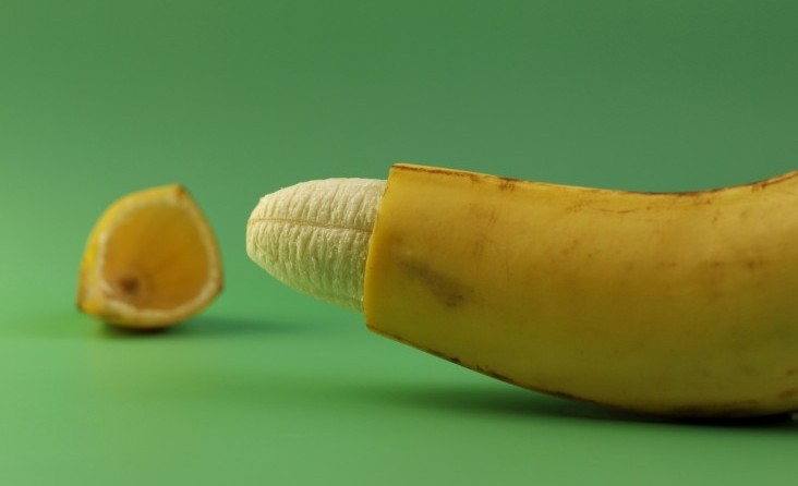 Sünnet